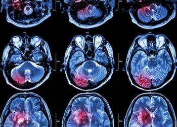 Dùng AI để ‘ghi hình’ và phát lại giấc mơ, tại sao không?