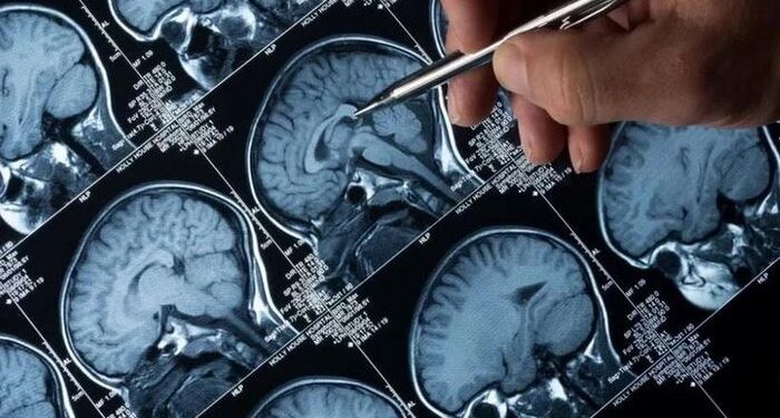 Phát triển công nghệ mới giúp phát hiện các khối u ác tính chính xác hơn